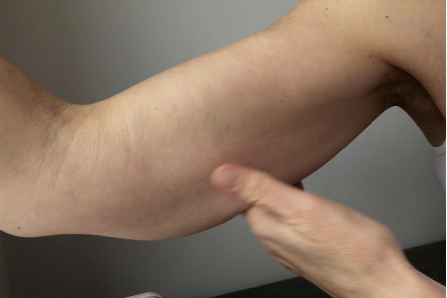 Paciente com indicação de cirurgia reparadora após negativa do plano de saúde
